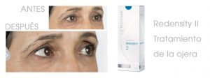Keti Eye Clinic Ophthalmology Clinic foto2