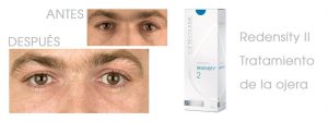Keti Eye Clinic Ophthalmology Clinic foto5